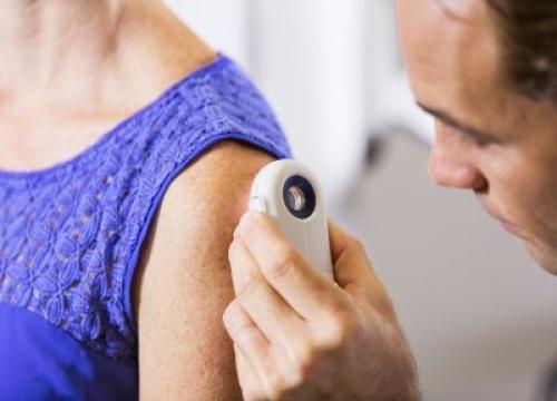Doctor checking a patients skin with dermatoscope