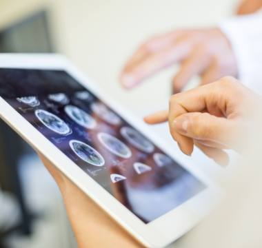 Doctors looking at a brain scan on an ipad