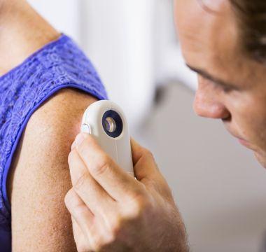 Doctor checking a patients skin with dermatoscope