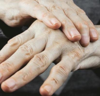 Close up of person's hands, one hand placed on top of the other